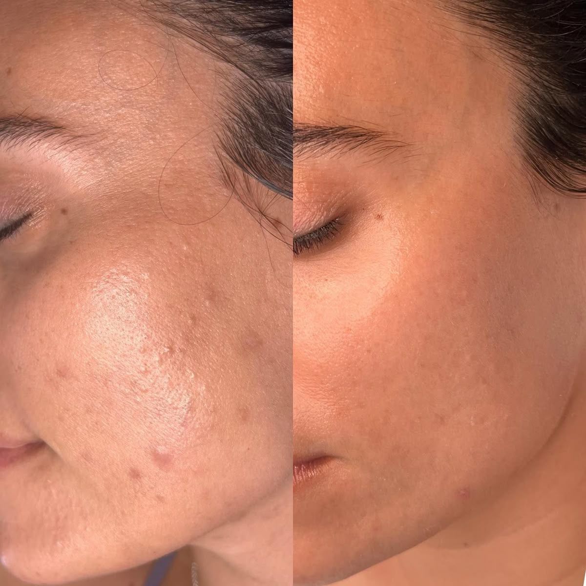 Before and after skin transformation